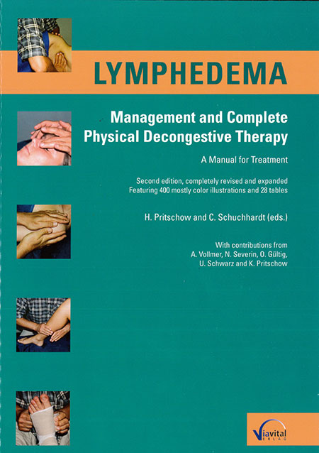 Lymphedema