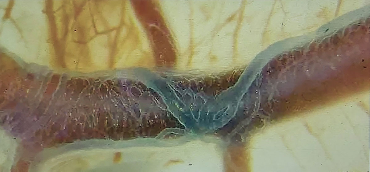 resorption 90% resorption via the lymphatic system: initial lymphatic vessels pass into pre-collectors and collectors (with the kind permission of Prof. Joerg Wilting, University Göttingen)